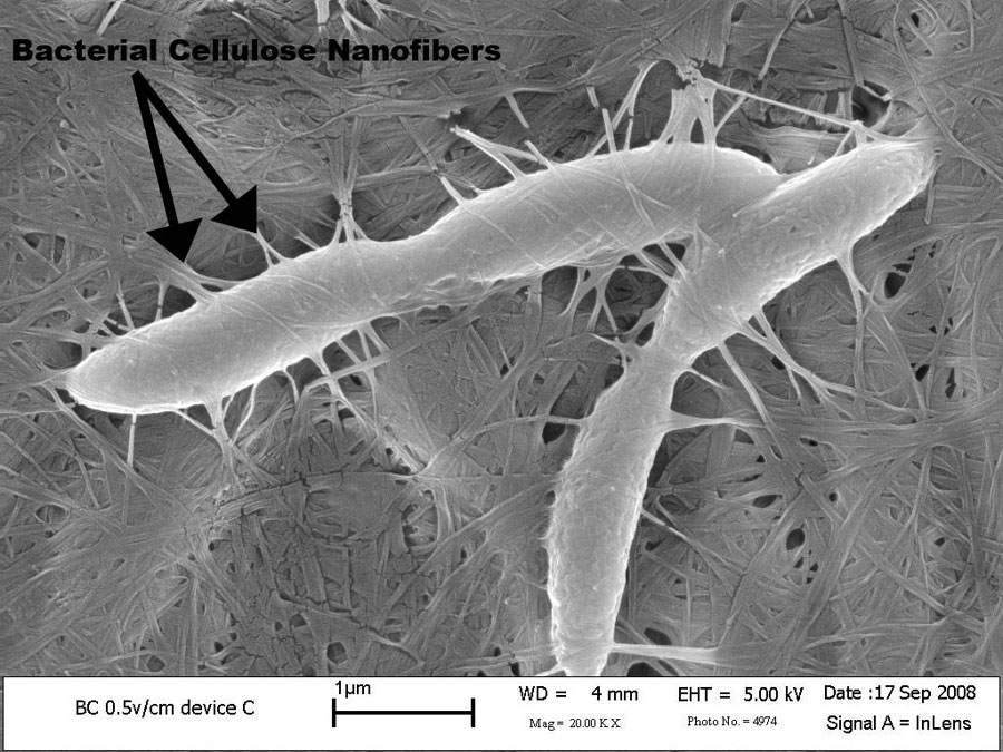 <em>Acetobacter Xylinum</em> cells embedded in and producing cellulose nanofibers.