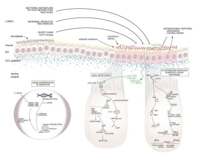 An illustration of how the bacterium Clostridium difficile affects the intestinal lining
