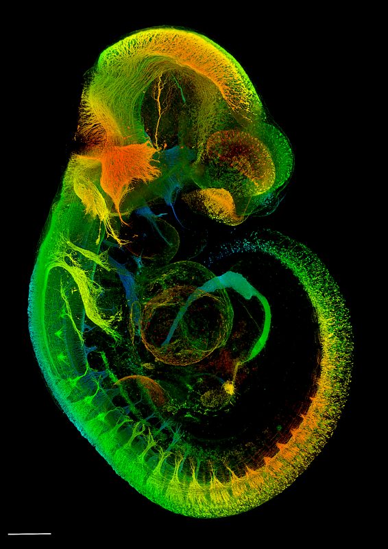 Mouse embryo and its brain