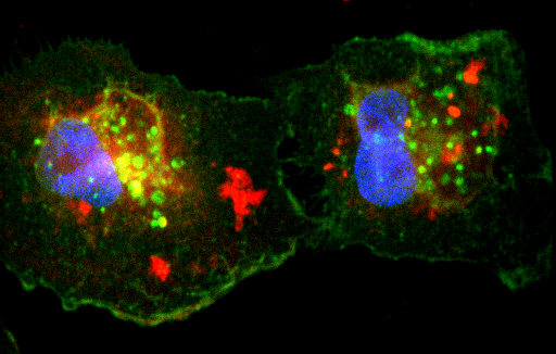 Triple negative breast cancer cells targeted by peptide drug