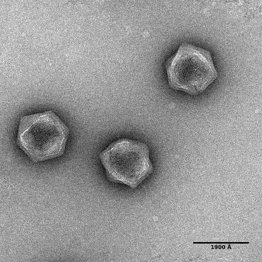 Electron micrograph image of a AaV, a giant virus that infects and kills a unicellular alga that causes harmful algae blooms. Giant viruses that belong to the same group as AaV can frequently insert their genomes into the genomes of their hosts. Image courtesy of Chuan Xiao and Yuejiao Xian, University of Texas at El Paso; Steven W. Wilhelm and Eric R. Gann, University of Tennessee, Knoxville.